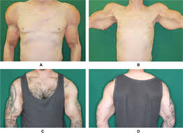 Image result for SYNTHOL