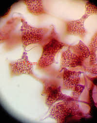 Attēlu rezultāti vaicājumam “Cribraria languescens macro”