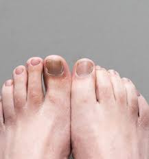 Image result for lunula nail