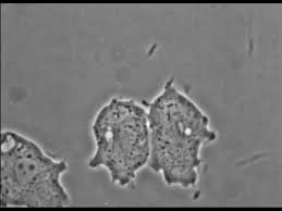 Attēlu rezultāti vaicājumam “Didymium crustaceum plasmodium”