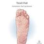 q=https://en.m.wikipedia.org/wiki/Trench_foot from my.clevelandclinic.org