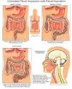 Economy impaction during racism~ | ~what causes fecal impaction in ...