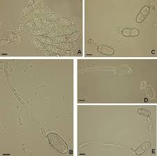 Attēlu rezultāti vaicājumam “Sawadaea tulasnei”