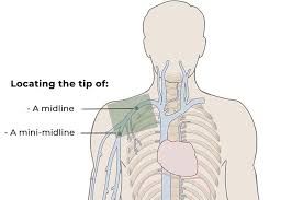 Image result for body midline
