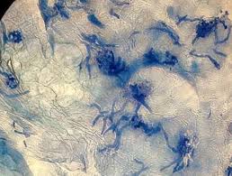 Attēlu rezultāti vaicājumam “Badhamia versicolor spores”