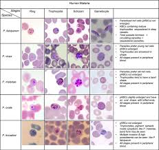 Attēlu rezultāti vaicājumam “Dianema depressum plasmodium”