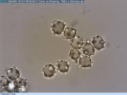 Attēlu rezultāti vaicājumam “Clavulinopsis helvola”