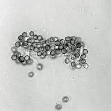 Attēlu rezultāti vaicājumam “Phleogena faginea stalked”