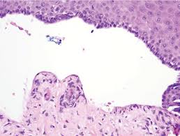 Attēlu rezultāti vaicājumam “Pemphigus borealis”