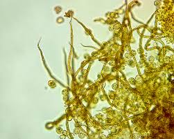 Attēlu rezultāti vaicājumam “Trichia botrytis”