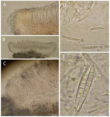 Attēlu rezultāti vaicājumam “Cliostomum corrugatum”