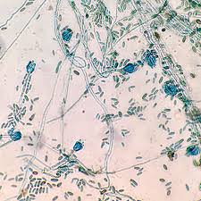 Attēlu rezultāti vaicājumam “Ptilidium pulcherrimum sporophyte”