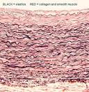 3. Connective Tissue