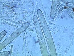 Attēlu rezultāti vaicājumam “Peziza varia”