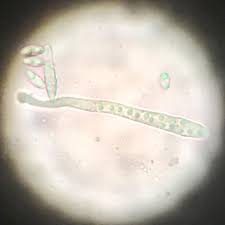 Attēlu rezultāti vaicājumam “Ionomidotis irregularis”