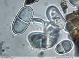 Attēlu rezultāti vaicājumam “Acrocordia gemmata”