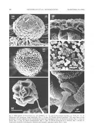 Attēlu rezultāti vaicājumam “Stemonitopsis subcaespitosa spores”