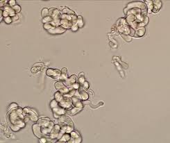 Attēlu rezultāti vaicājumam “Lichenoconium xanthoriae”