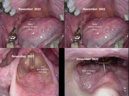 Attēlu rezultāti vaicājumam “Pemphigus borealis”