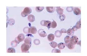 Attēlu rezultāti vaicājumam “Cribraria purpurea plasmodium”