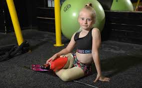 Attēlu rezultāti vaicājumam “Diderma umbilicatum young”