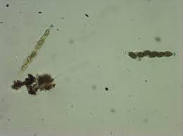 Attēlu rezultāti vaicājumam “Melanospora lagenaria”