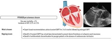 Image result for Hemonetics CCS