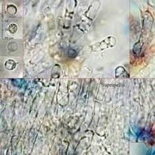 Attēlu rezultāti vaicājumam “Rimbachia neckerae”