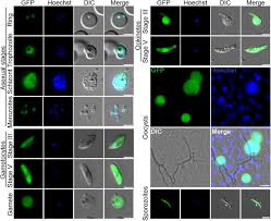 Attēlu rezultāti vaicājumam “Oligonema favogineum plasmodium”