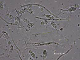 Attēlu rezultāti vaicājumam “Thelopsis rubella”