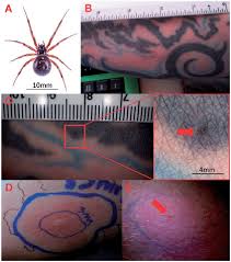 Attēlu rezultāti vaicājumam “Steatoda grossa female”