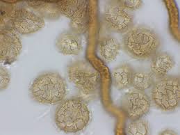 Attēlu rezultāti vaicājumam “Heterotrichia ferruginea (syn. Arcyria ferruginea) spores”
