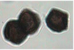 Attēlu rezultāti vaicājumam “Badhamia melanospora spores”