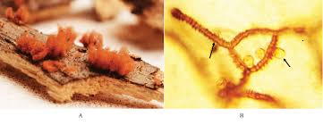 Attēlu rezultāti vaicājumam “Arcyria denudata spores”