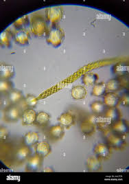 Attēlu rezultāti vaicājumam “Oligonema persimile spores”
