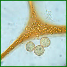 Attēlu rezultāti vaicājumam “Cribraria rufa spores”