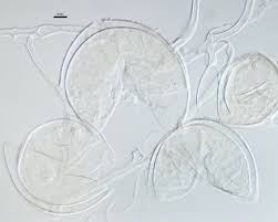 Attēlu rezultāti vaicājumam “Stemonaria irregularis spores”