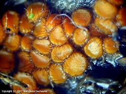 Attēlu rezultāti vaicājumam “Cheilymenia stercorea”