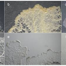 Attēlu rezultāti vaicājumam “Claustria didermoides”