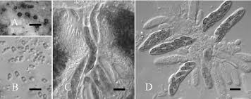 Attēlu rezultāti vaicājumam “Vouauxiomyces santessonii”