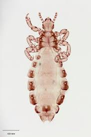 Attēlu rezultāti vaicājumam “Pediculus humanus capitis”