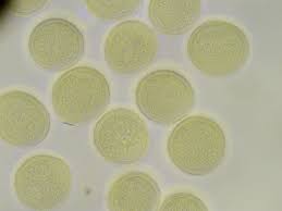 Attēlu rezultāti vaicājumam “Trichia alpina”