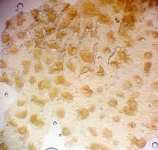 Attēlu rezultāti vaicājumam “Lycogala fuscoolearium macro”