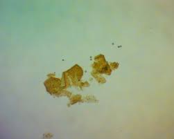 Attēlu rezultāti vaicājumam “Licea pygmaea spores”