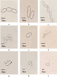 Attēlu rezultāti vaicājumam “Erysiphe galeopsidis”