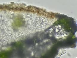 Attēlu rezultāti vaicājumam “Lecanora chlarotera”