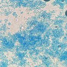 Attēlu rezultāti vaicājumam “Trichia alpina spores”