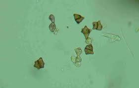 Attēlu rezultāti vaicājumam “Cephaloziella elachista macro”