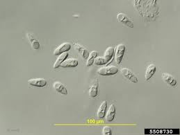 Attēlu rezultāti vaicājumam “Reticularia lobata spores”