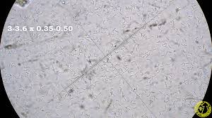 Attēlu rezultāti vaicājumam “Skeletocutis nivea”